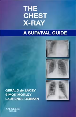 خرید و دانلود نسخه کامل کتاب The Chest X-Ray: A Survival Guide