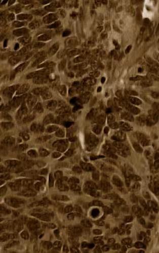 خرید و دانلود نسخه کامل کتاب Lung Cancer: Diagnostic and Therapeutic Methods and Reviews