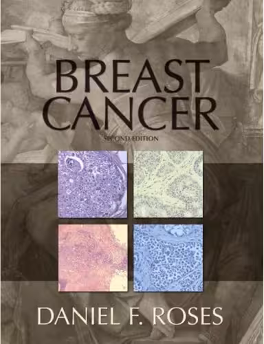 خرید و دانلود نسخه کامل کتاب Breast Cancer (2nd Edition)
