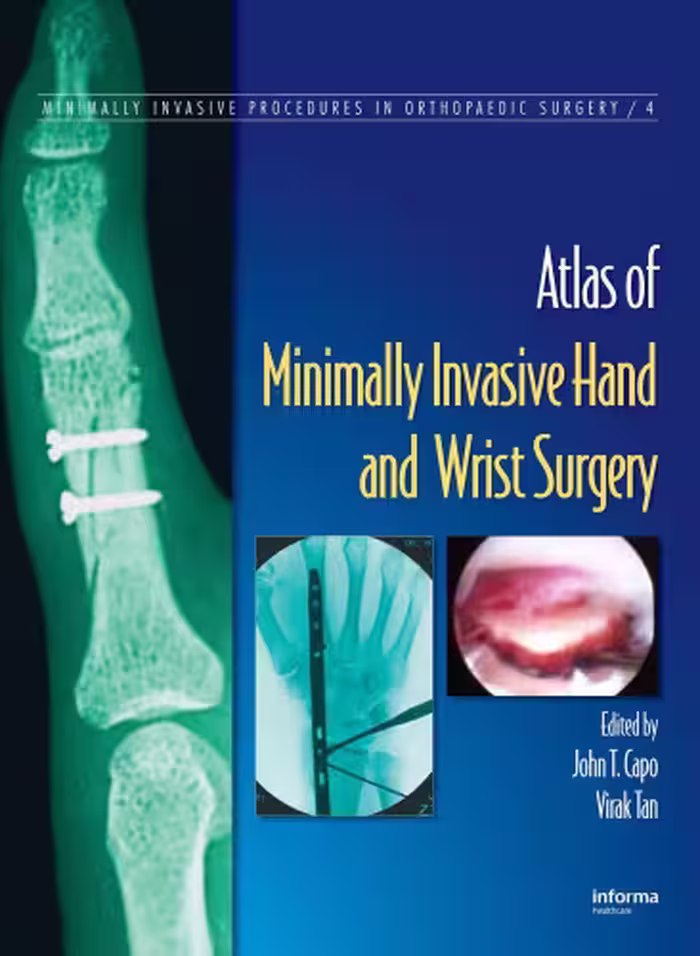 خرید و دانلود نسخه کامل کتاب atlas of minimal invasive hand and wrist surgery