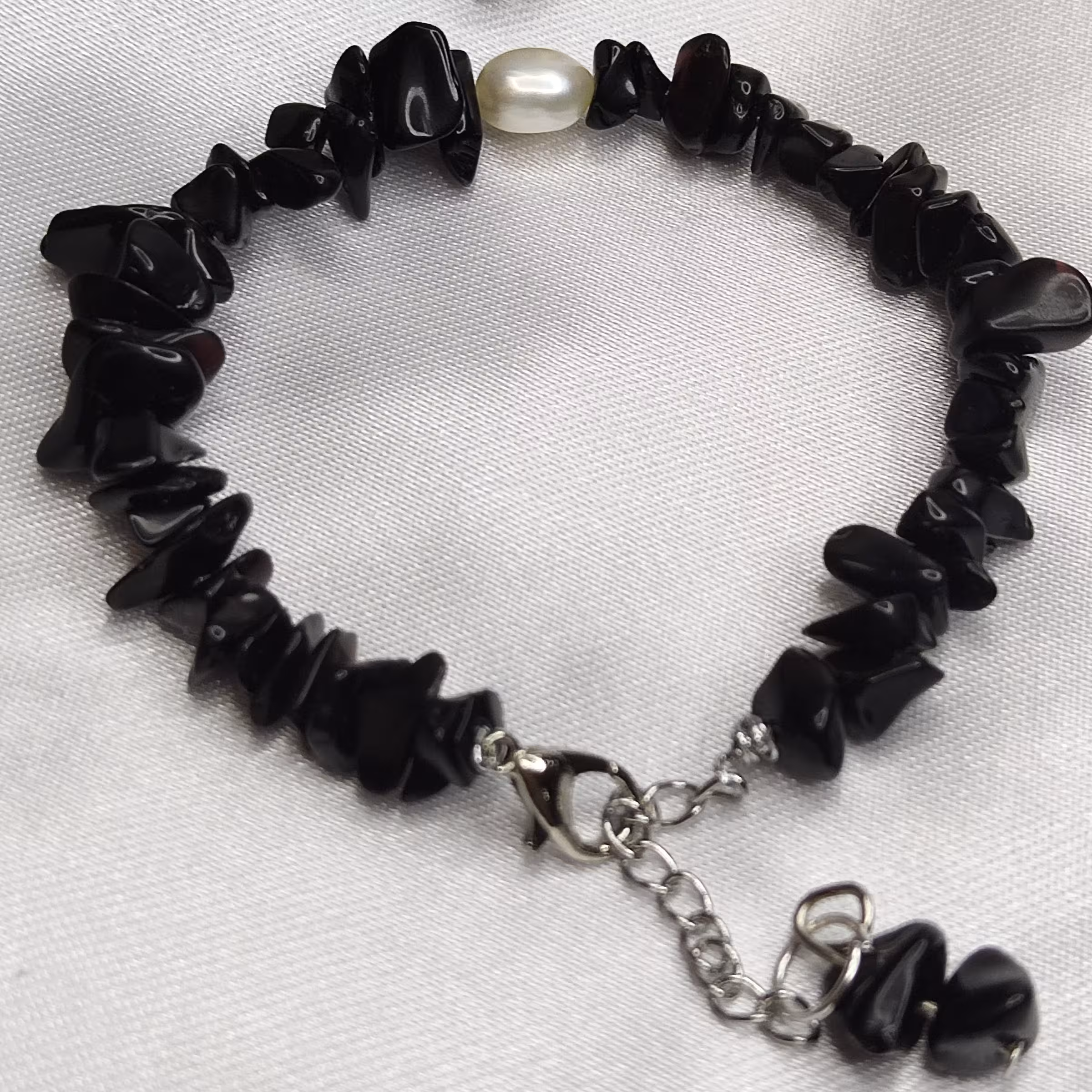 مروارید انیکس