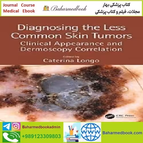 Diagnosing the Less Common Skin Tumors TRUE PDF price 1€ - کتاب پزشکی بهار