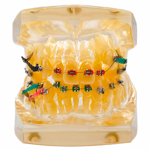 مولاژ دندان ارتودنسی | Dental mollage