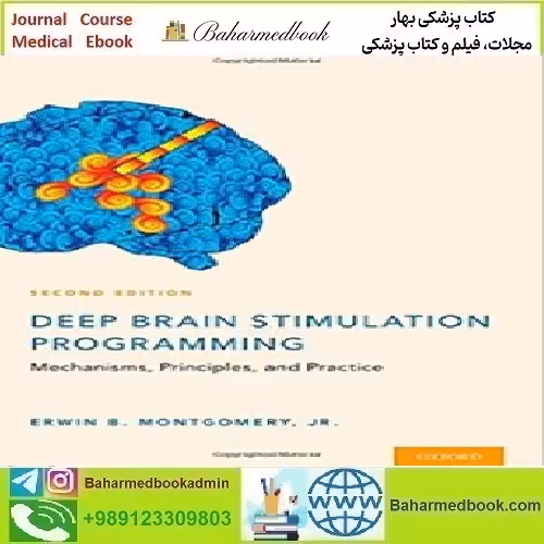 Deep Brain Stimulation Programming Mechanisms Principles an