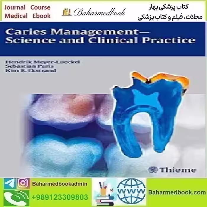 Caries Management Science and Clinical Practice 2013 T