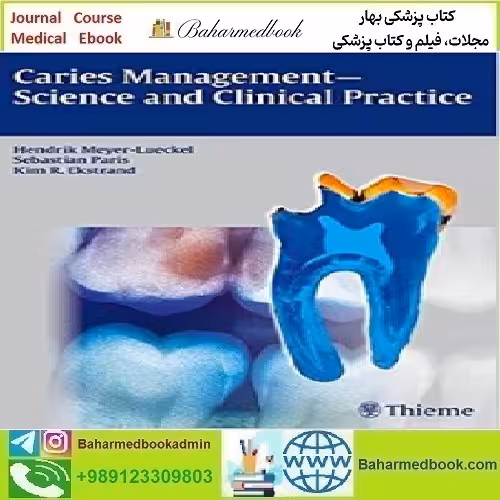 Caries Management Science and Clinical Practice 2013 T