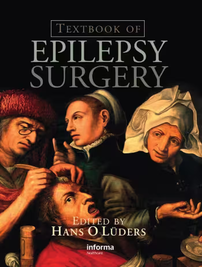خرید و دانلود نسخه کامل کتاب Textbook of Epilepsy Surgery