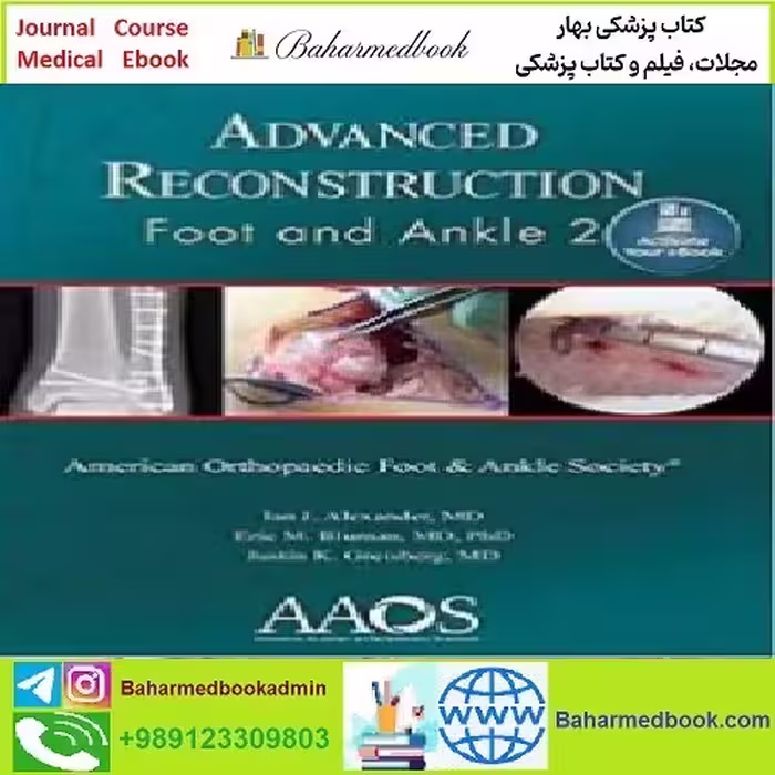 Advanced Reconstruction Foot and Ankle TRUE PDF price 1€ - کتاب پزشکی بهار