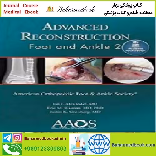 Advanced Reconstruction Foot and Ankle TRUE PDF price 1€ - کتاب پزشکی بهار