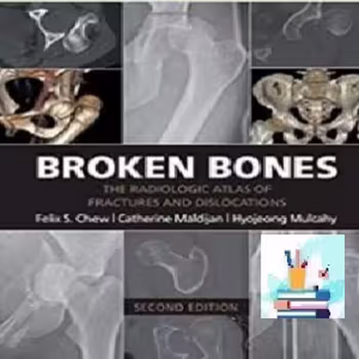 Broken Bones TRUE PDF price 1€
