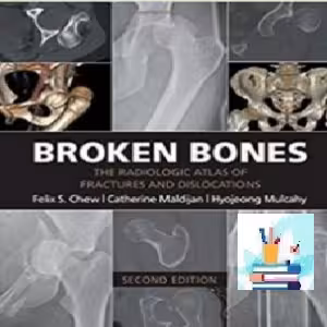 Broken Bones TRUE PDF price 1€