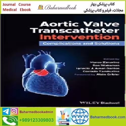 Aortic Valve Transcatheter Intervention TRUE PDF price 1€ - کتاب پزشکی بهار