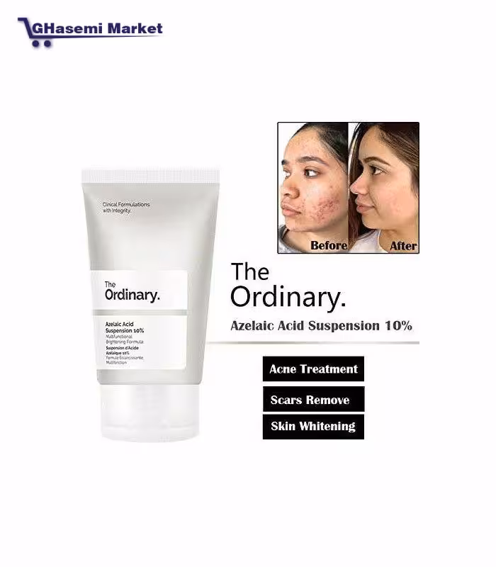 ⚜کرم آزلائیک اسید 10% اوردینریThe Ordinary Azelaic Acid Suspension 10% 30ml - قاسمی مارکت