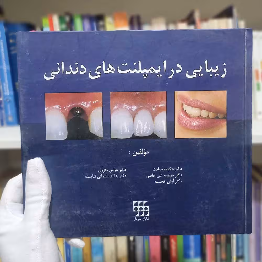 کتاب زیبایی در ایمپلنت های دندانی