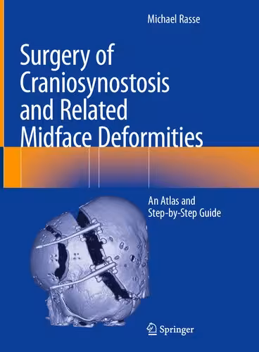 خرید و دانلود نسخه کامل کتاب Surgery of Craniosynostosis and Related Midface Deformities: An Atlas and Step-by-Step Guide