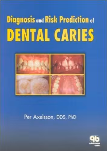 خرید و دانلود نسخه کامل کتاب Diagnosis and Risk Prediction of Dental Caries, Volume 2