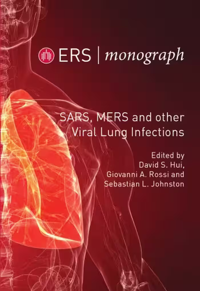 خرید و دانلود نسخه کامل کتاب SARS, MERS and other Viral Lung Infections