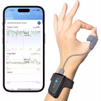 پالس اکسیمتر مچی هوشمند ویاتوم Checkme O2 Max