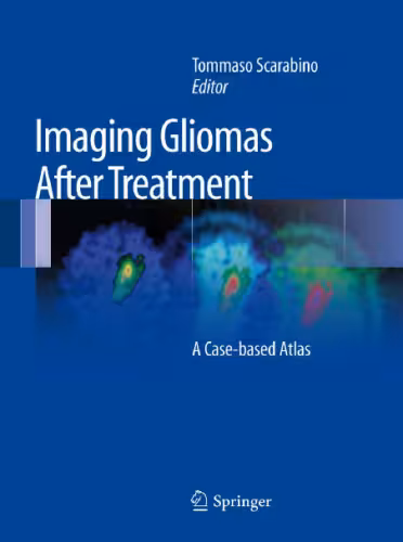 خرید و دانلود نسخه کامل کتاب Imaging Gliomas After Treatment: A Case-based Atlas