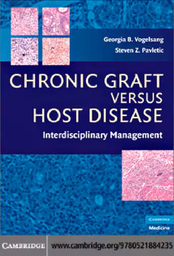 خرید و دانلود نسخه کامل کتاب Chronic Graft Versus Host Disease: Interdisciplinary Management