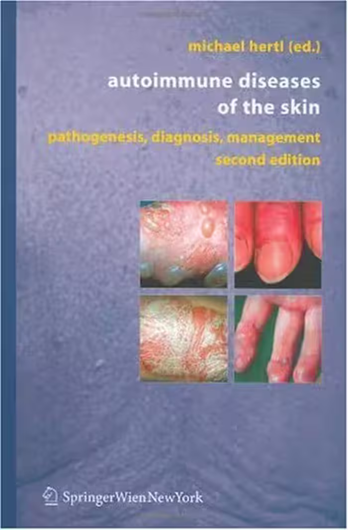 خرید و دانلود نسخه کامل کتاب Atypical Parkinsonian Disorders: Clinical and Research Aspects