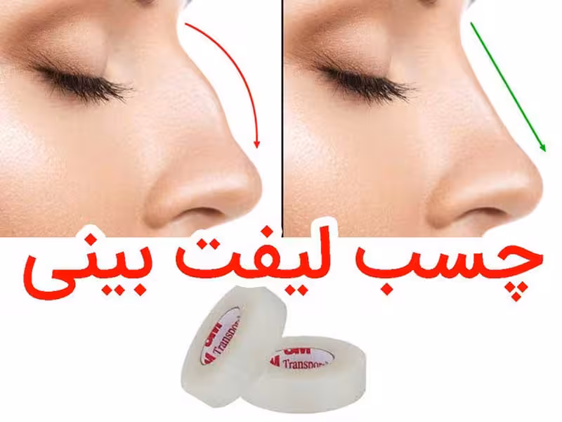چسب لیفت بینی