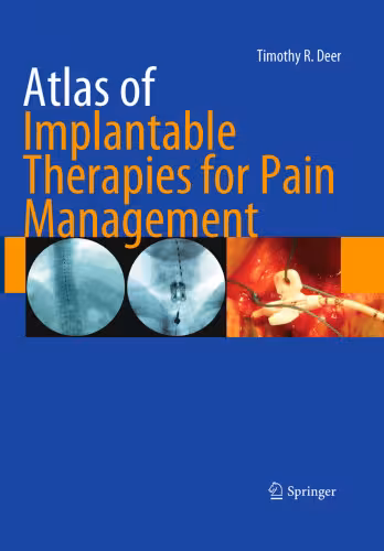 خرید و دانلود نسخه کامل کتاب Atlas of Implantable Therapies for Pain Management