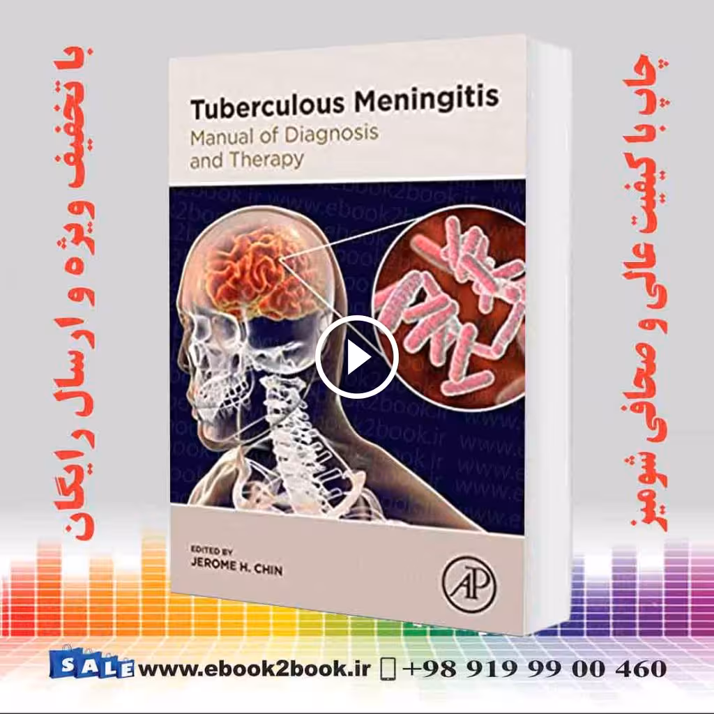 Tuberculous Meningitis