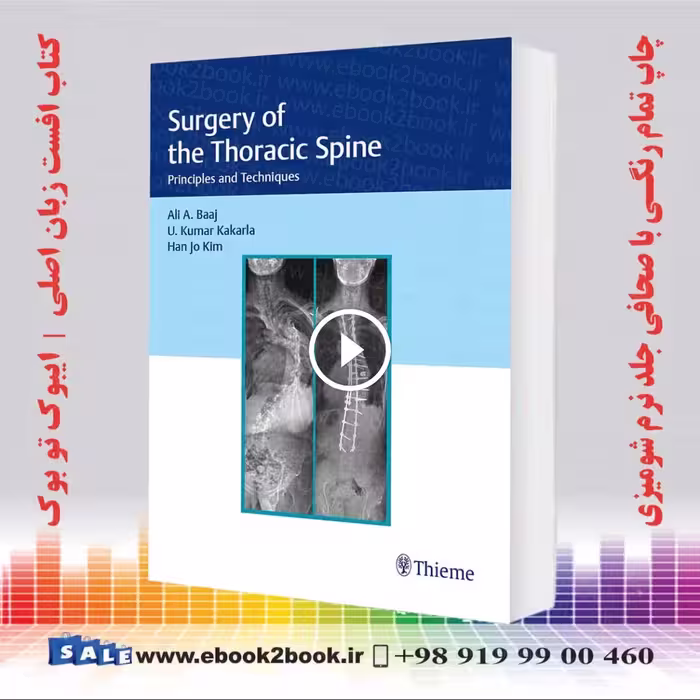 Surgery of the Thoracic Spine