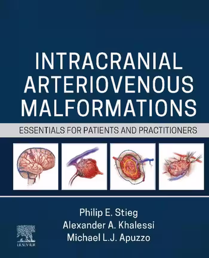 خرید و دانلود نسخه کامل کتاب Intracranial Arteriovenous Malformations: Essentials for Patients and Practitioners