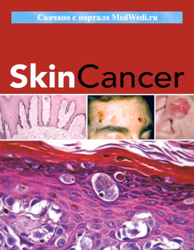 خرید و دانلود نسخه کامل کتاب Skin Cancer