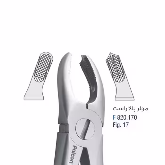 مولر بالا راست - کوشا