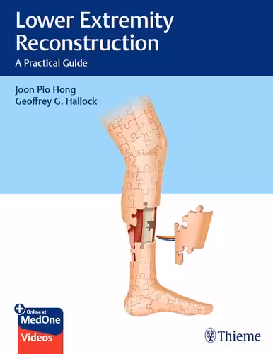 خرید و دانلود نسخه کامل کتاب Lower Extremity Reconstruction: A Practical Guide
