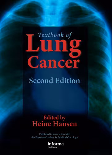 خرید و دانلود نسخه کامل کتاب Textbook of Lung Cancer,