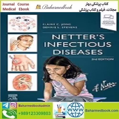 Netter's Infectious Diseases 2022 TRUE PDF price 1€ - کتاب پزشکی بهار