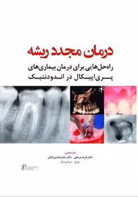 درمان مجدد ریشه راه حل هایی برای درمان بیماری های پری اپیکال در اندودنتیک
