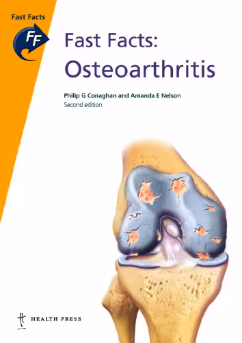 خرید و دانلود نسخه کامل کتاب Fast Facts: Osteoarthritis