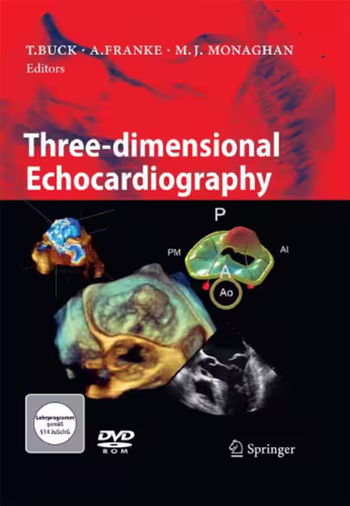 خرید و دانلود نسخه کامل کتاب Three-dimensional Echocardiography