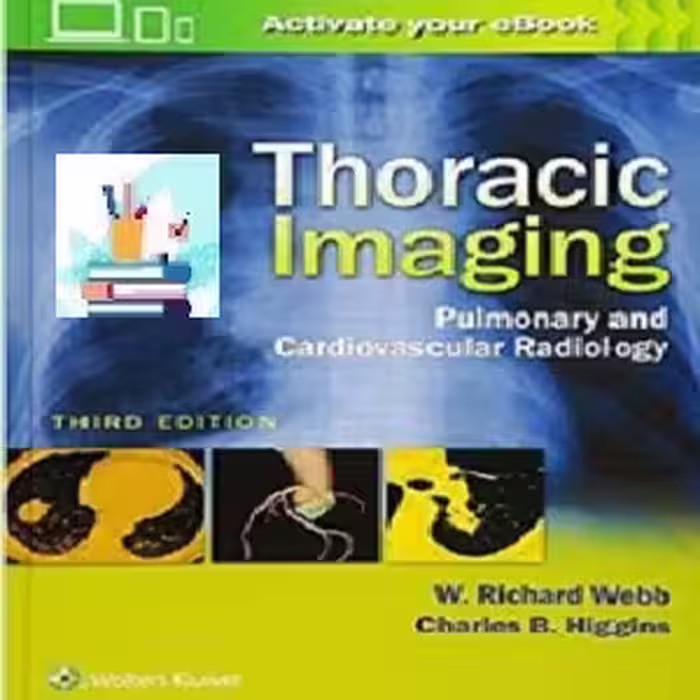 Thoracic Imaging CONVRTEF PDF price 1€