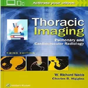 Thoracic Imaging CONVRTEF PDF price 1€