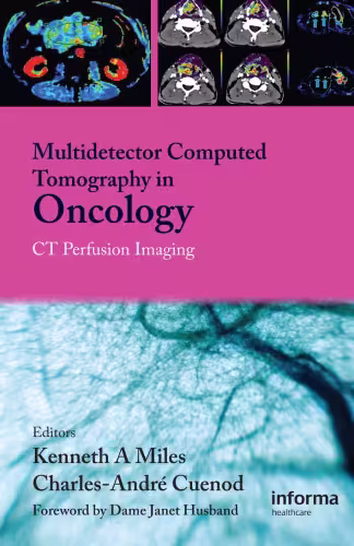 خرید و دانلود نسخه کامل کتاب Multi-Detector Computed Tomography in Oncology: CT Perfusion Imaging