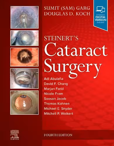 خرید و دانلود نسخه کامل کتاب Steinert&#039;s Cataract Surgery