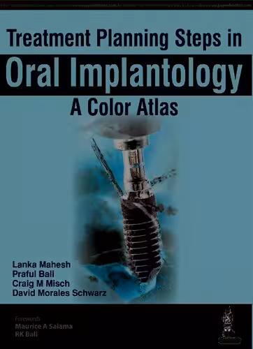 خرید و دانلود نسخه کامل کتاب Treatment Planning Steps in Oral Implantology: A Color Atlas