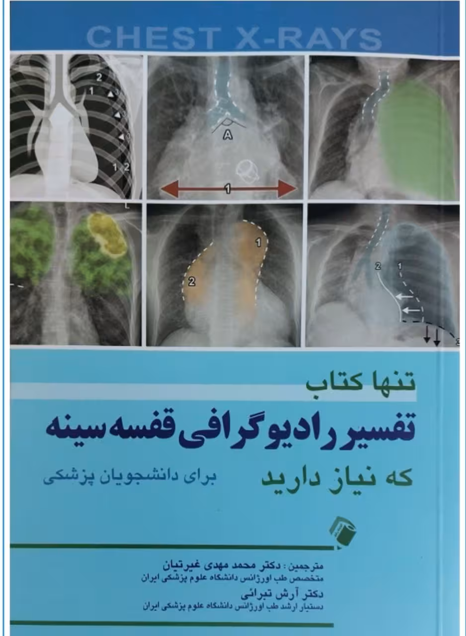 تنها کتاب تفسیر رادیوگرافی قفسه سینه که نیاز دارید