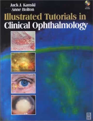 خرید و دانلود نسخه کامل کتاب Illustrated tutorials in clinical ophthalmology