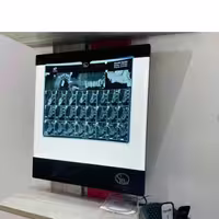 نگاتوسکوپ دندانپزشکی سوئیچ مد Switch Med مدل SM50 OPG با پایه S2