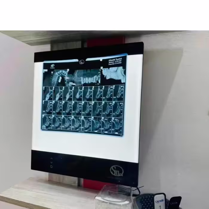 نگاتوسکوپ دندانپزشکی سوئیچ مد Switch Med مدل SM50 OPG با پایه S2