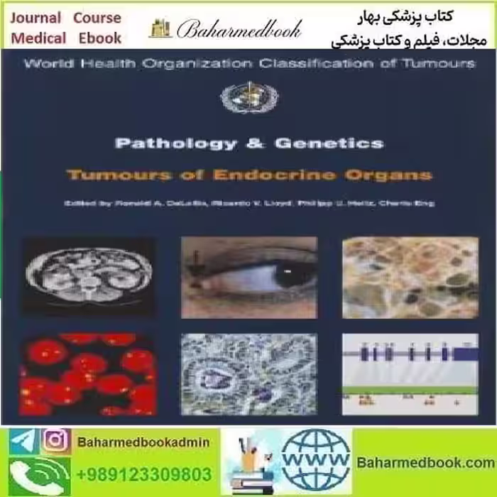 Pathology and Genetics of Tumours of Endocrine