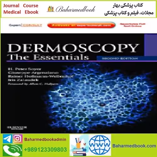Dermoscopy The Essentials TRUE PDF price 1€ - کتاب پزشکی بهار
