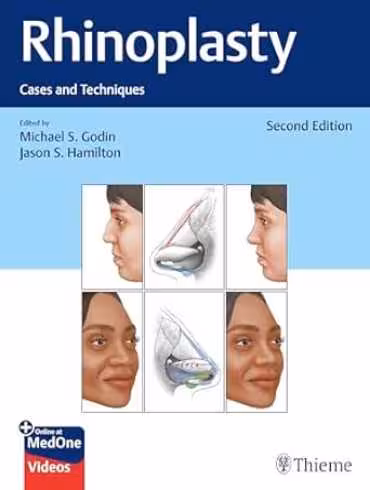 خرید و دانلود کتاب Rhinoplasty: Cases and Techniques 2nd Edition Video